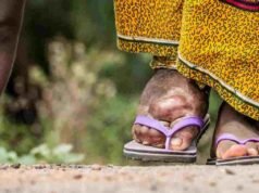 नवापुर तालुक्यात हत्तीरोग नियंत्रणासाठी औषधोपचार मोहिम सुरु elephantisis disease Navapur