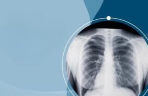 आरोग्यसेवेची अचूकता वाढवणाऱ्या प्रत्येक रेडिओलॉजिस्टला आणि तंत्रज्ञांना मनापासून सलाम!