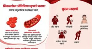 सिकलसेल ॲनिमिया एक अनुवंशिक रक्तविकार