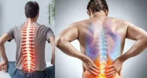 18 ऑगस्टला मोफत मणक्याचे आजार तपासणी शिबीर,05 सप्टेंबरला होणार मोफत शस्त्रक्रिया